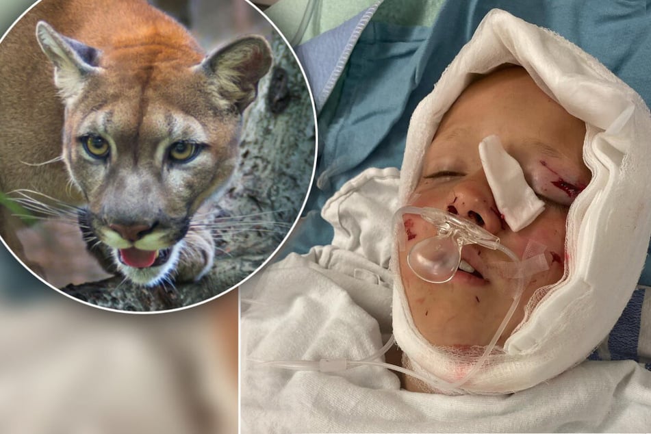 Boy miraculously survives cougar bite to the head thanks to heroic family friend