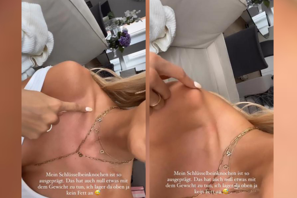 Gerda Lewis (27) zeigte ihren Followern ihr Schlüsselbein, das sich extrem abzeichnete.