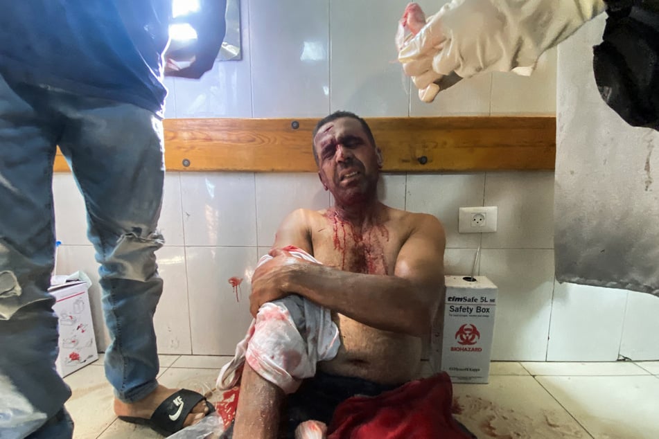 Medics aid Palestinian photojournalist Hatem Omar, who was injured in Israeli strikes on Nasser hospital in Khan Younis in the southern Gaza Strip on August 25, 2025.