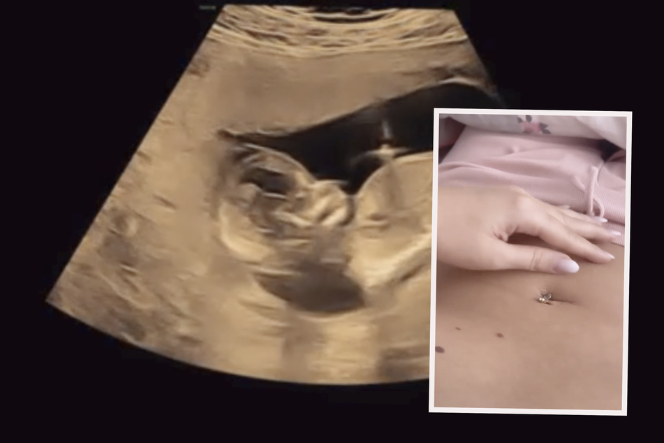 In einem Instagram-Reel gab Chethrin bereits erste Einblicke in ihre frühe Schwangerschaft.