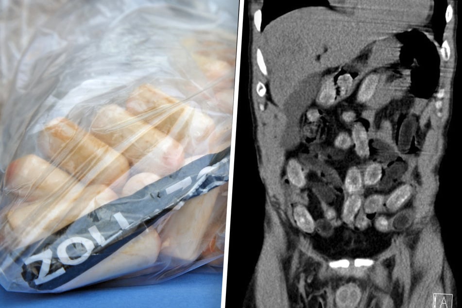 Unglaublicher Fund: Mann mit Kokain und Heroin im Bauch auf dem Weg zur Familie