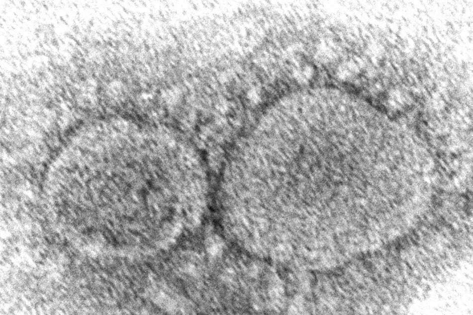 Das Coronavirus unter der Lupe: Nun kommt mit "Arcturus" eine weitere Variante hinzu.