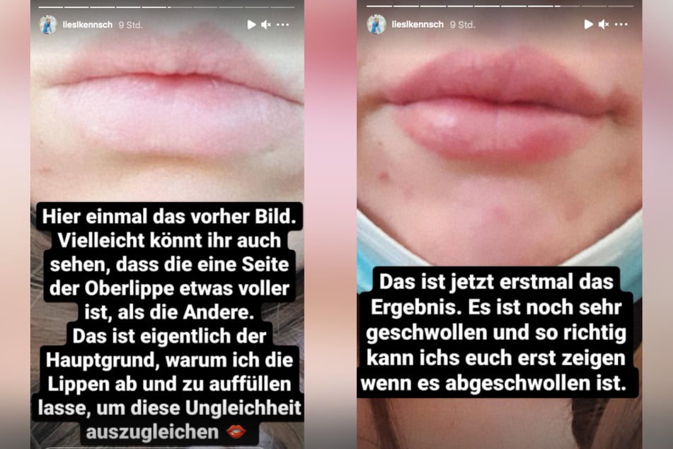 Diesen Vorher-Nachher-Vergleich postete Liesl. (Montage)