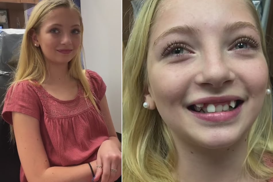 Mädchen mit krummen Zähnen wird gemobbt, ihr Zahnarzt hat eine wichtige Botschaft