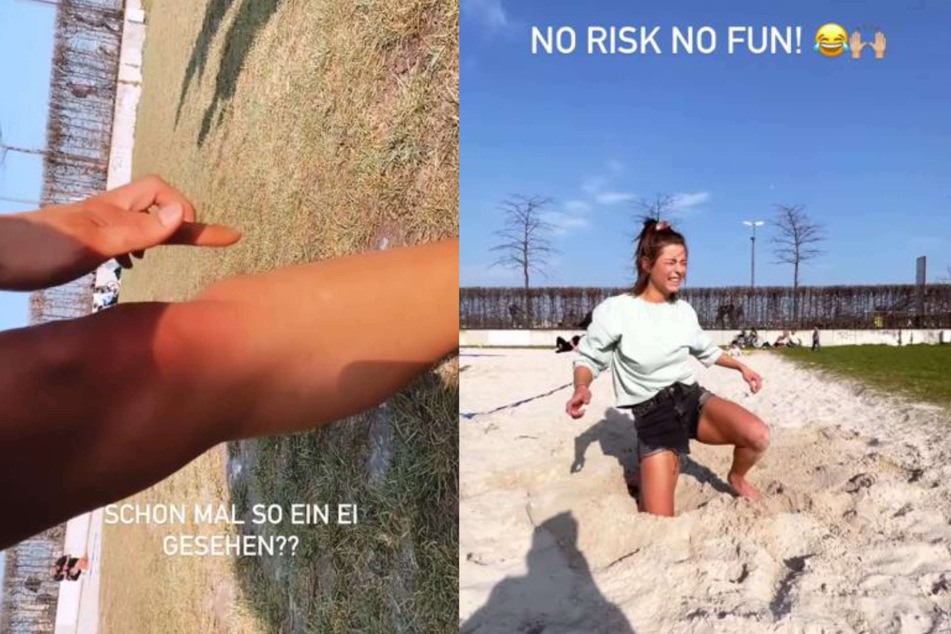Jennifer Lange (27) verletzte sich am Mittwoch beim Radschlagen in Köln. Bei Instagram zeigte sie die Verletzung an ihrem Bein und nahm es mit Humor.