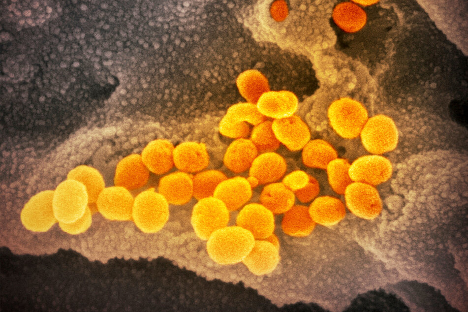 Eine elektronenmikroskopische Aufnahme zeigt das Coronavirus (SARS-CoV-2), das aus der Oberfläche von im Labor kultivierten Zellen austritt.