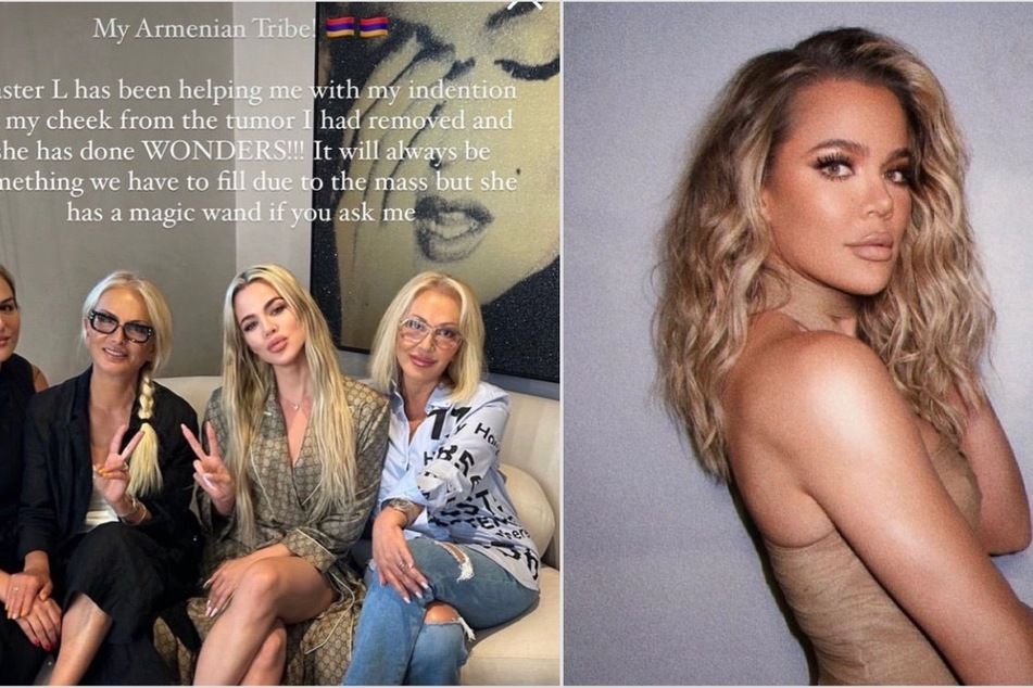 Khloé Kardashian (r.) recently looked back at her scary skin cancer incident last year.
