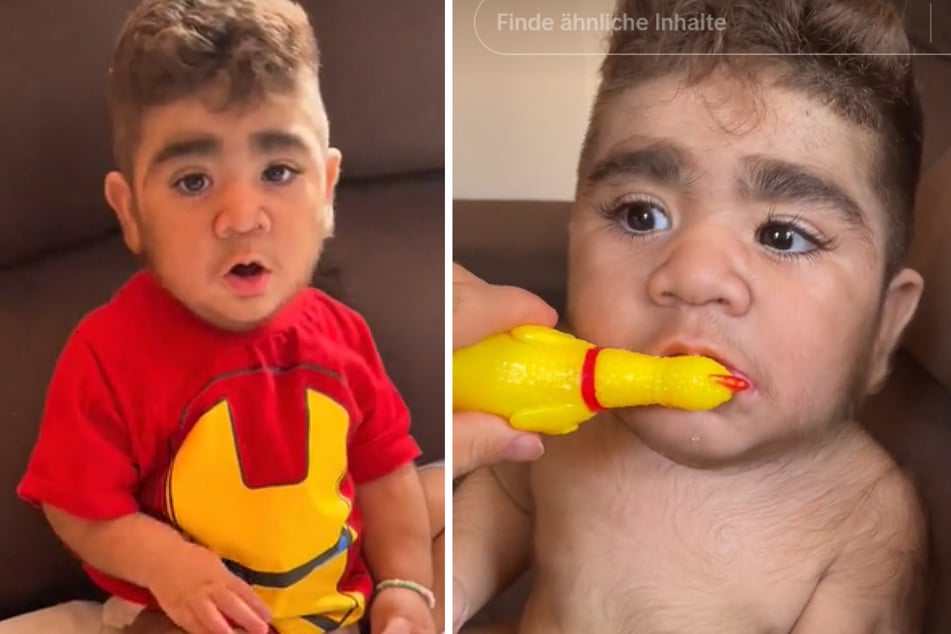 Baby Joao Miguel ist wegen seiner Körperbehaarung zu einem Internet-Star geworden.