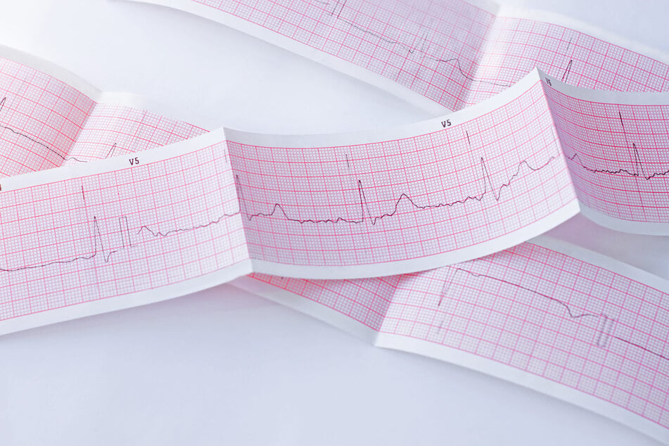 Mithilfe eines modernen, kontinuierlichen EKG-Monitorings wollen die Forschenden die Erholungsphase nach einer extremen Ausdauerbelastung genauer untersuchen. (Symbolbild)