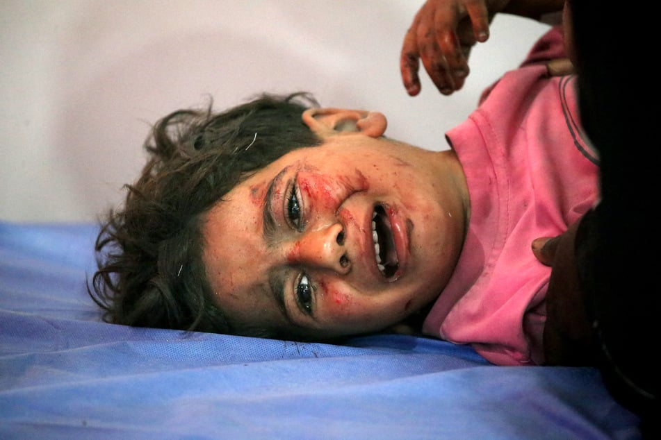 An injured child cries while receiving medical care at the Al-Awda Hospital in the Nuseirat refugee camp in the central Gaza Strip, following an Israeli strike, on May 29, 2025.