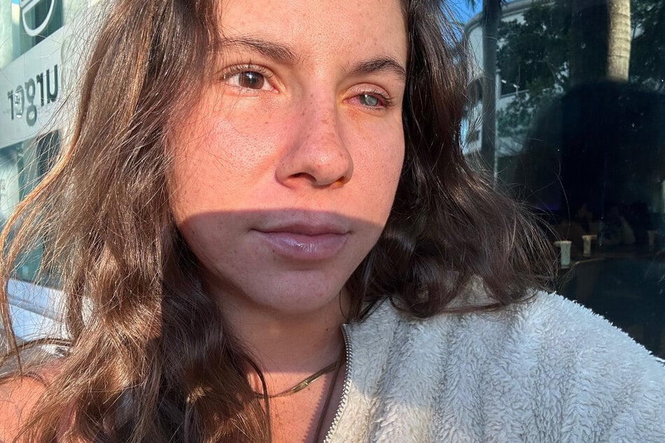 Vivian Nosovitsky (21) wachte mit starken Schmerzen auf.