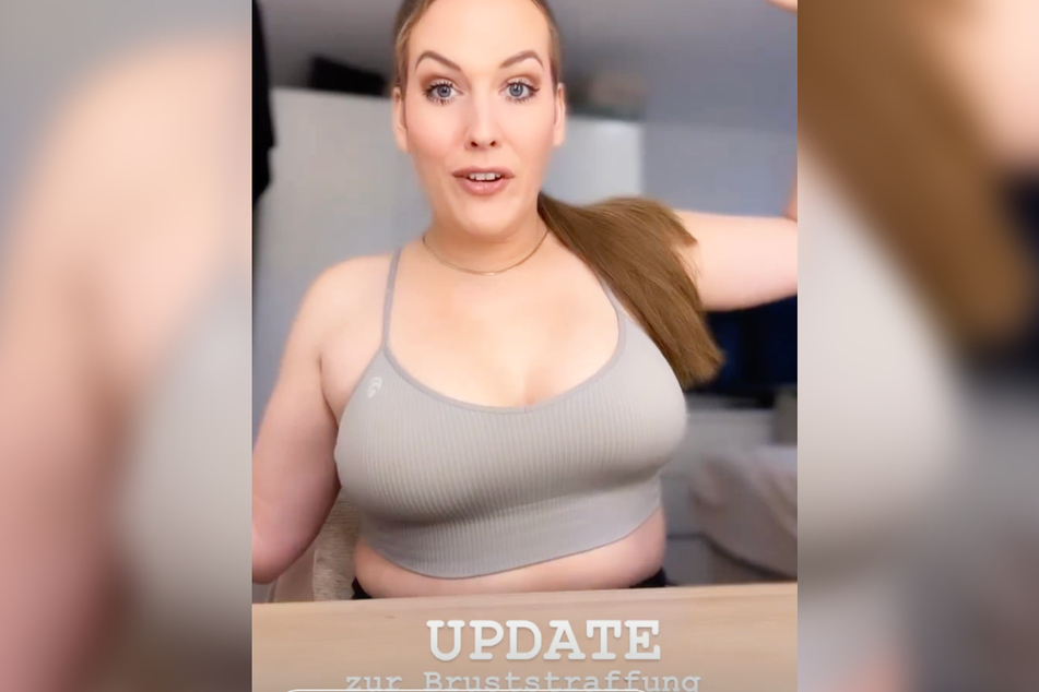 Am Freitag wandte sich Josimelonie (29) auf Instagram an ihre Fans und präsentierte ein Update zu ihrer Bruststraffung vor einigen Wochen.