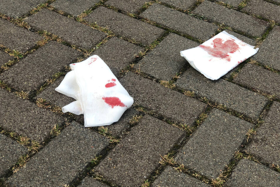 Blutspuren an der Gemeinschaftsunterkunft.