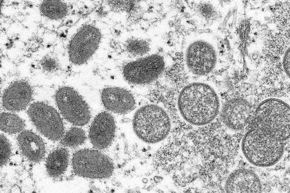 Ovale Affenpockenviren (l.) und kugelförmige unreife Virionen (r.) unter einem Elektronenmikroskop.