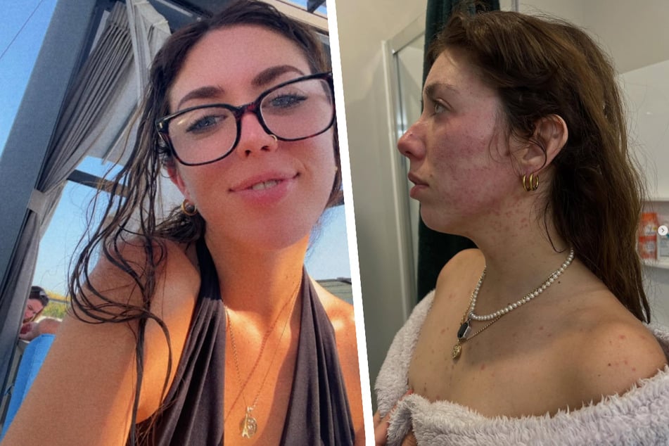 Nachdem sie Taubheitsgefühle in der rechten Körperhälfte verspürte, erhielt Paige (27) die erschütternde Diagnose.