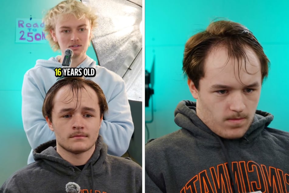 Ein 16-Jähriger mit schlimmen Geheimratsecken hatte Barber Grant aufgesucht.