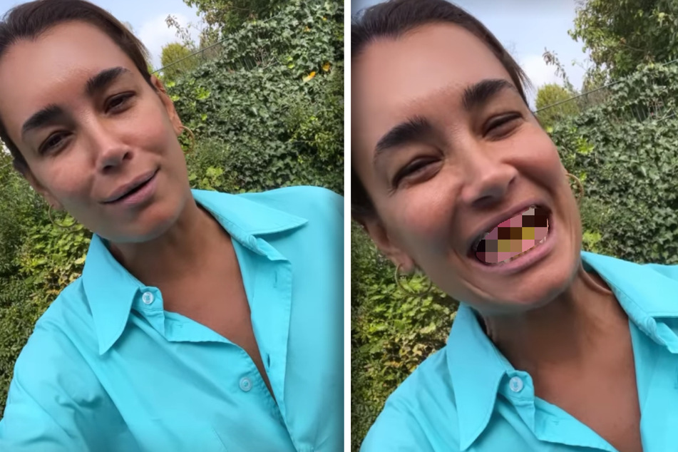 Jana Ina Zarrella schockt Fans: Was ist mit ihren Zähnen passiert?