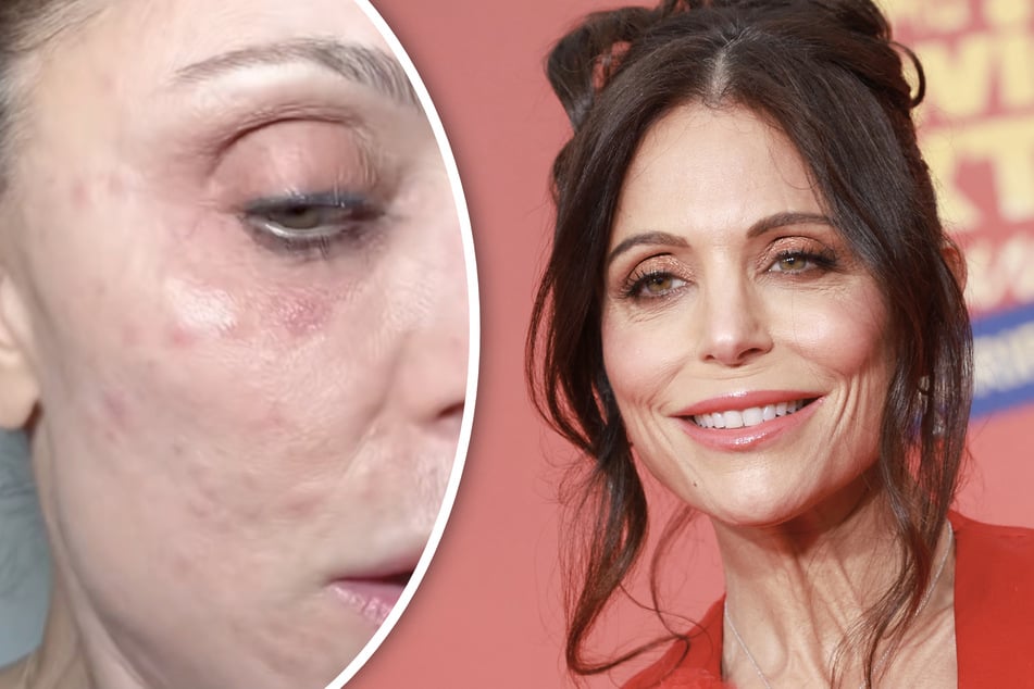 Heftig! Reality-Star bringt dieses "Andenken" aus Luxus-Urlaub mit