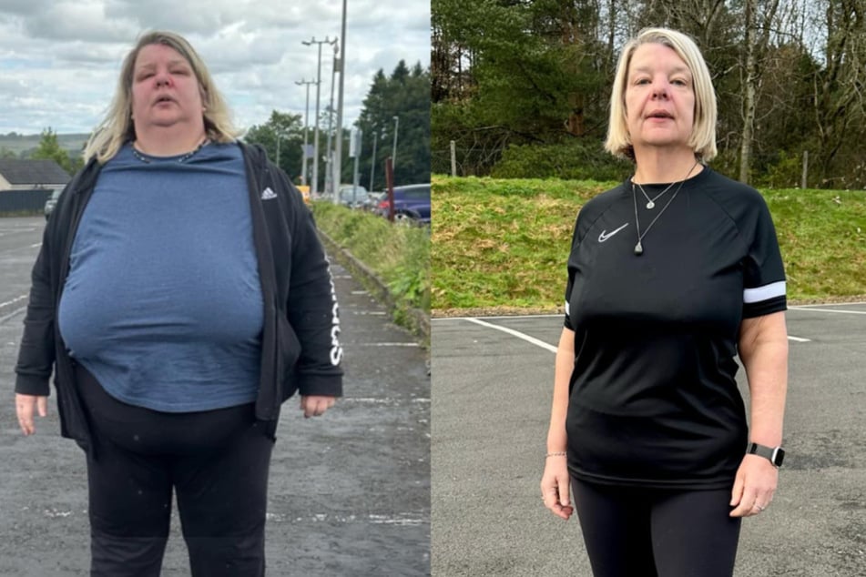 This woman lost 207 pounds! Her secret will shock you