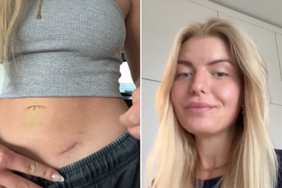 Antonia Hemmer packt über Krankheit aus: Diese Anzeichen gab es bei ihr