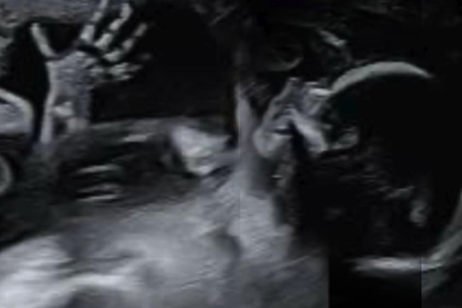 Mujer embarazada se somete a una ecografía: cuando ve la imagen más tarde, se queda sin palabras.