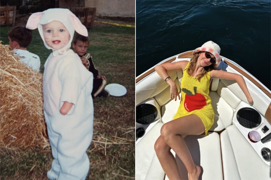 Lexi Brooks (25) leidet schon seit ihrer Geburt an einer Fehlbildung ihrer linken Hand.