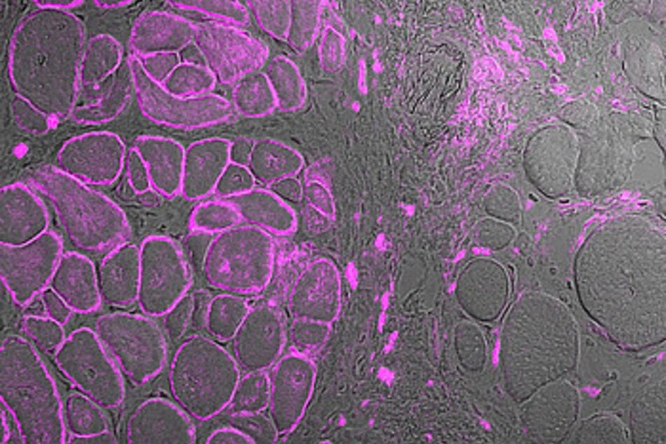 Den rechten Muskelfasern fehlt das Protein Dysferlin (violett). Die linken Muskelfasern sind mit dem Gen-Schere Crispr/Cas9 repariert worden und wachsen wieder.