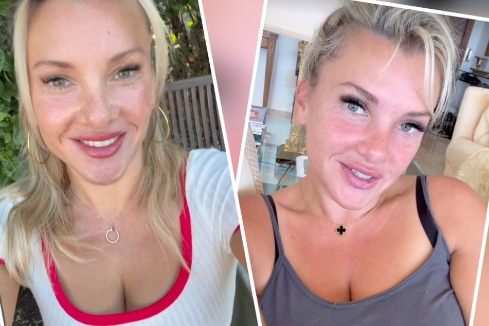 Evelyn Burdecki: Evelyn Burdecki offenbart Schönheitsfehler: Darunter hat sie jahrelang gelitten