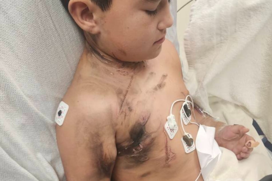 Der Achtjährige war mit heftigen Verletzungen in die Klinik gebracht worden.