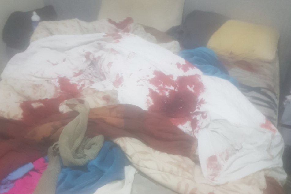 Überall Blut: Brooke Carrello war schockiert.