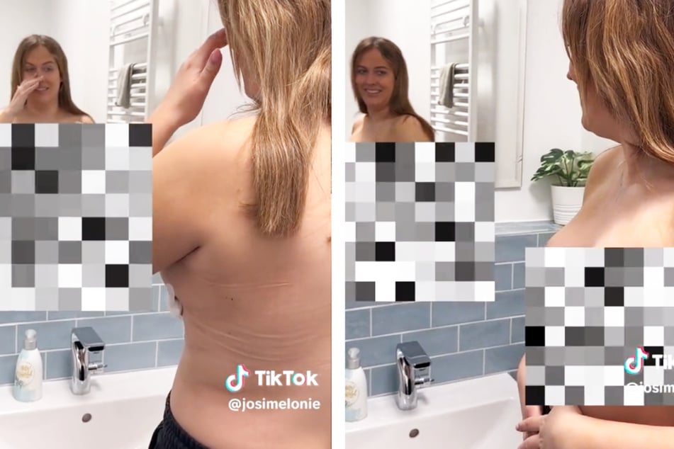 Ein TikTok-Video zeigt den Moment, in dem Josimelonie (29) erstmals ihre verkleinerten Brüste im Spiegel eines Badezimmers betrachtete.