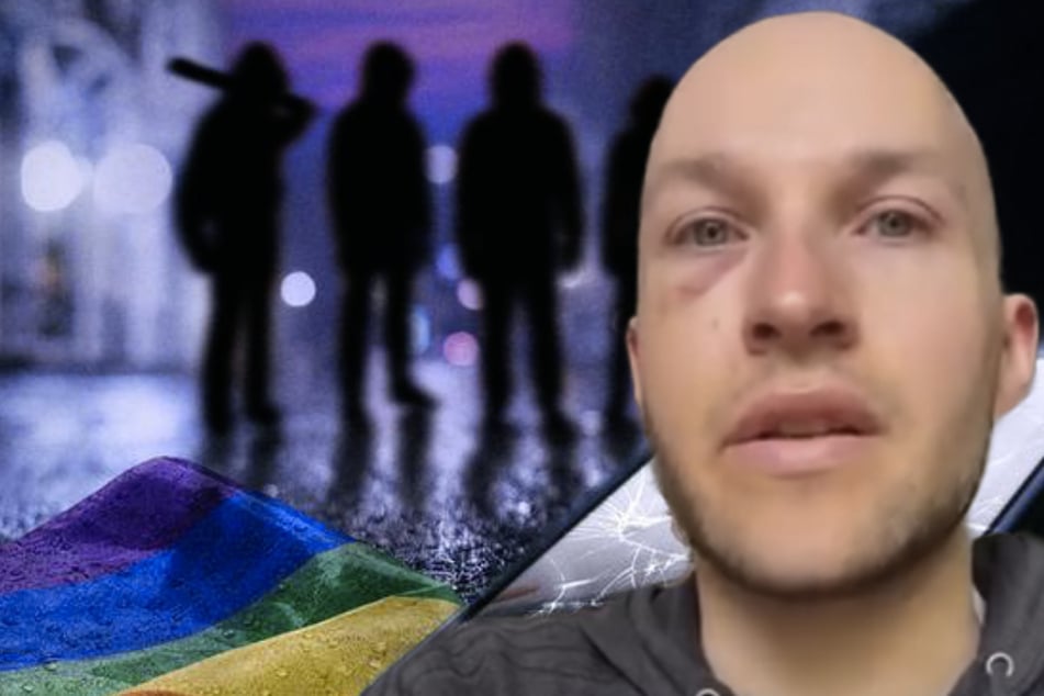 Leopold (32): Verprügelt und ausgeraubt, weil er schwul ist