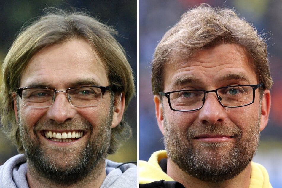 Bereits 2013 bestätigte Kult-Trainer Jürgen Klopp (54), dass er sich Haare einpflanzen ließ. Die Bilder zeigen ihn vor (l.) und nach dem Eingriff. (Archivfoto)
