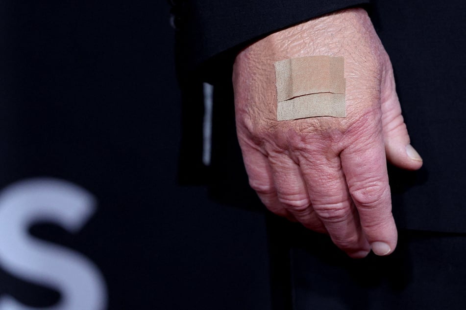 President Donald Trump's bandage is related to the amount of handshakes he engages in, according to the White House.