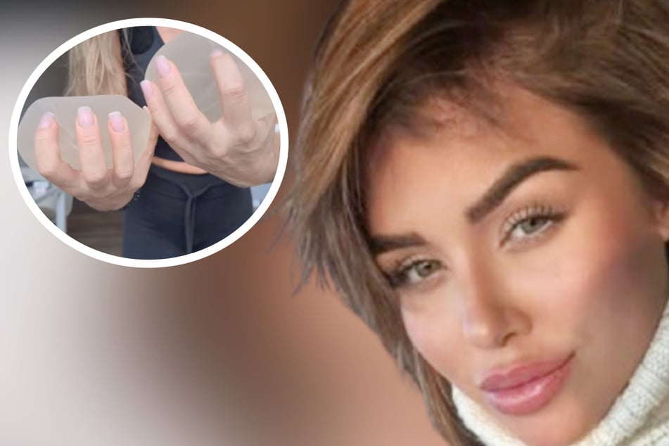Kim Gloss lässt sich zum dritten Mal Brüste operieren: Doch es gibt Komplikationen