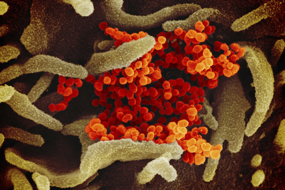 Eine rasterelektronenmikroskopische Aufnahme zeigt das Coronavirus Sars-CoV-2 (orange), das Covid-19 verursacht, wie es aus der Oberfläche von im Labor kultivierten Zellen (grün) austritt.