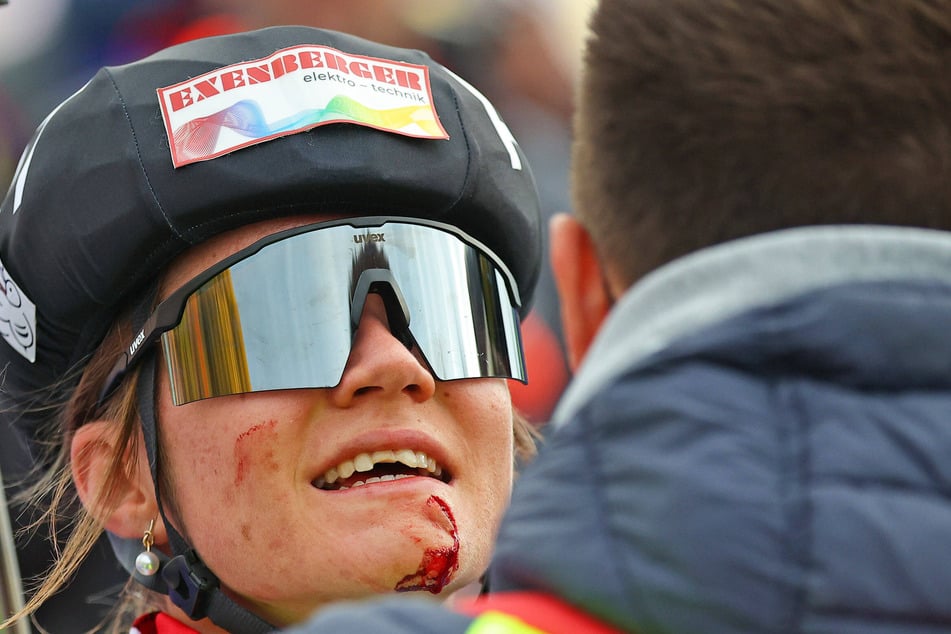 Lara Wagner (23) hatte sich beim Sturz nach der ersten Runde ordentlich wehgetan.