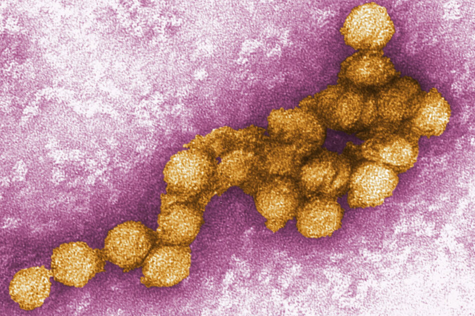 So sieht das West-Nil-Virus unterm Elektronenmikroskop aus.