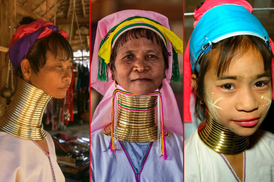 Neck elongation is a tradition practiced by the Padaung people in Myanmar and Thailand.
