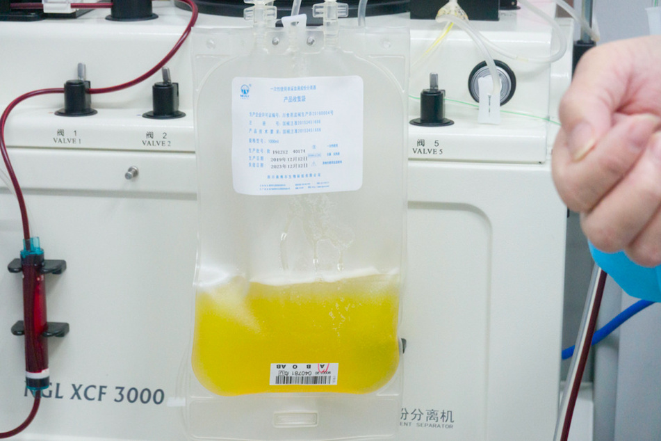 Gespendetes Plasma eines geheilten Coronavirus-Patienten wird in einem Plasmabeutel aufgefangen.