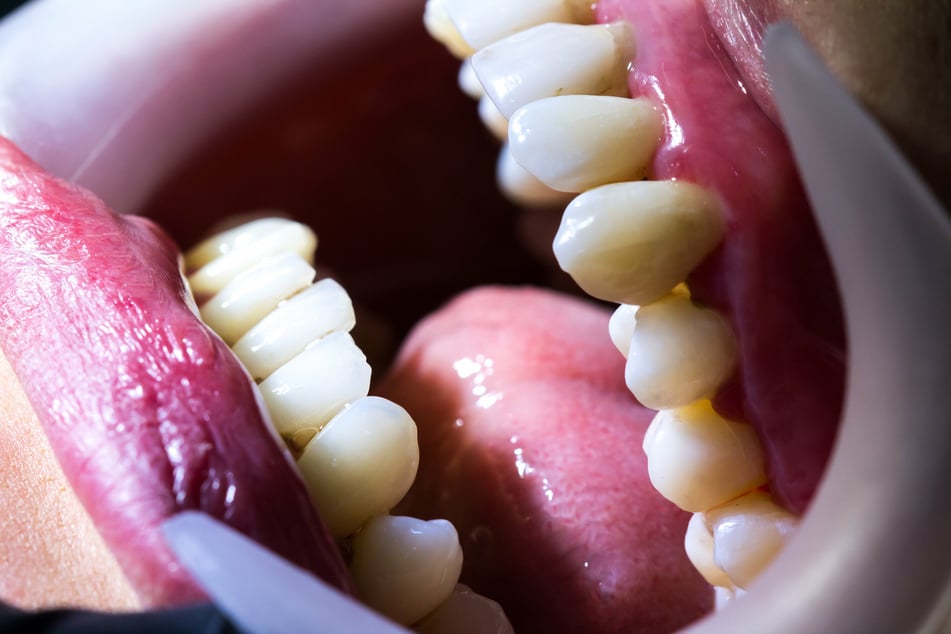 A woman has just been charged with a felony for illegally conducting dental surgery without a license after breaking into a dental office to pull teeth (stock image).