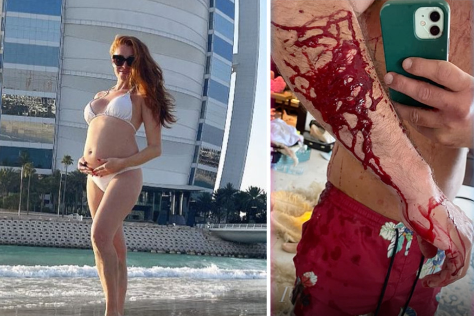 Die nun endlich bestätigte schwangere Georgina Fleur (31) legte sich in letzter Zeit mehrfach mit Kubilay Özdemir (41) an, der wohl der Vater ihres ungeborenen Kindes ist.