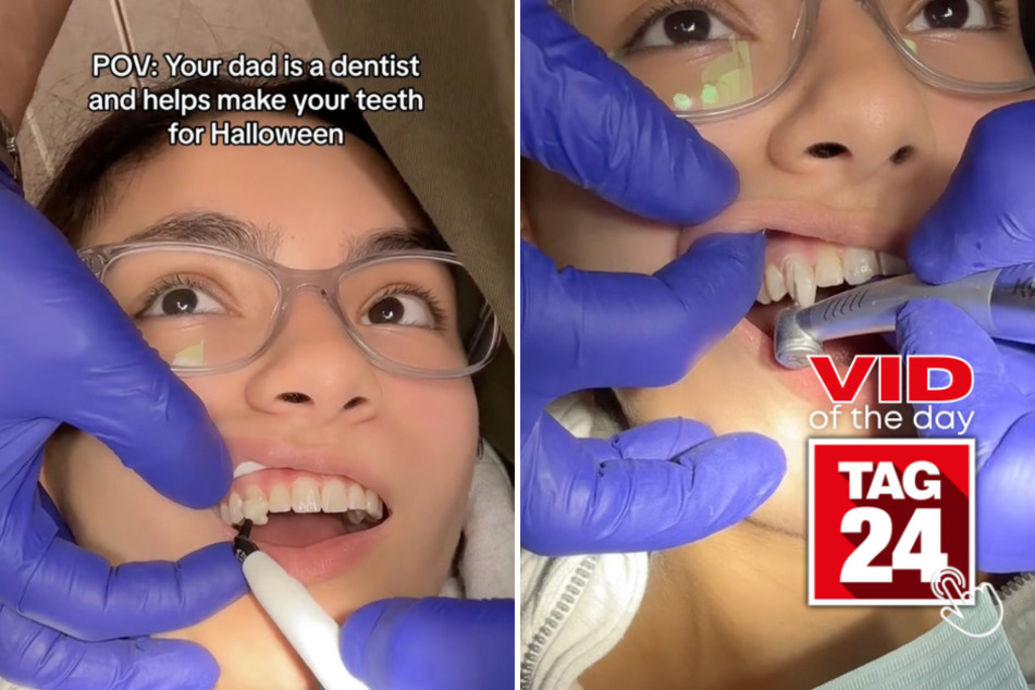viral videos: Viral Video of the Day for October 31, 2023: Dentist dad gives daughter a fang-tastic Halloween makeover