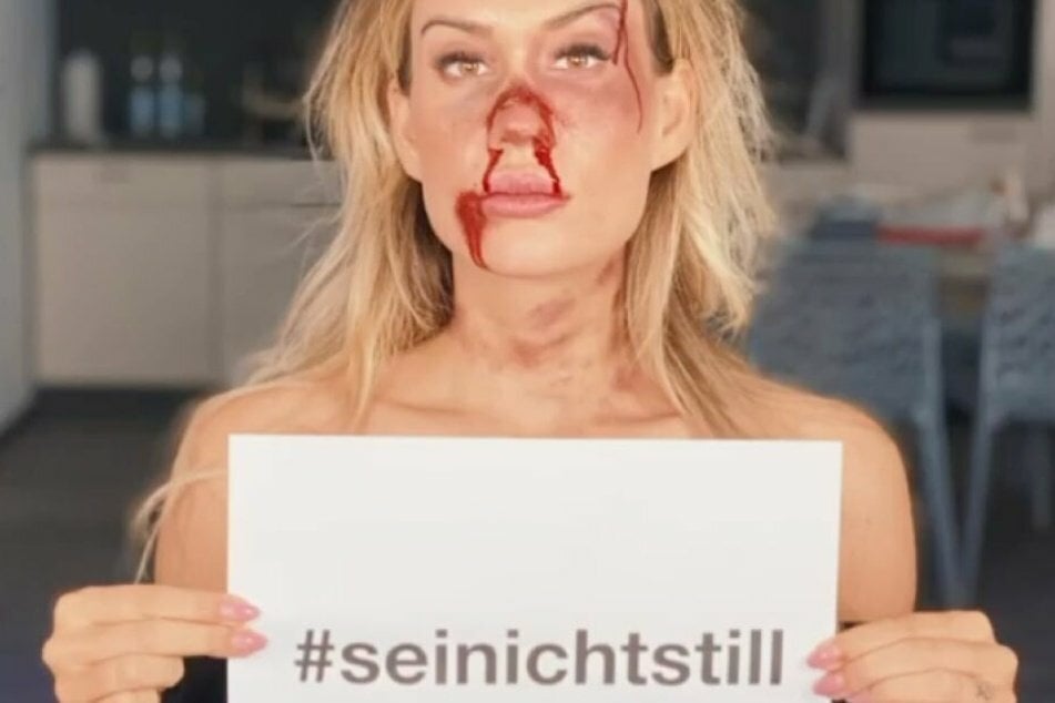 Sarah Bora (32) teilt ihre Erfahrung und setzt sich für Betroffene ein. Für ein Posting aus dem Jahre 2019 schminkte sie sich eindrucksvoll.