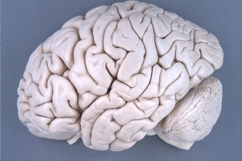 Das Gehirn eines Menschen - Schädigungen in der weißen Substanz, die häufig bei Menschen mit "Apfel"-Körperform festgestellt werden, führen zum kognitiven Verlust.