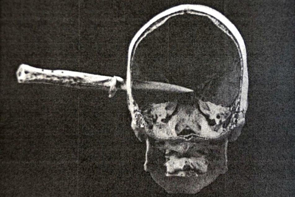 Tony B. rammte das Springmesser seinem Widersacher in den Kopf.