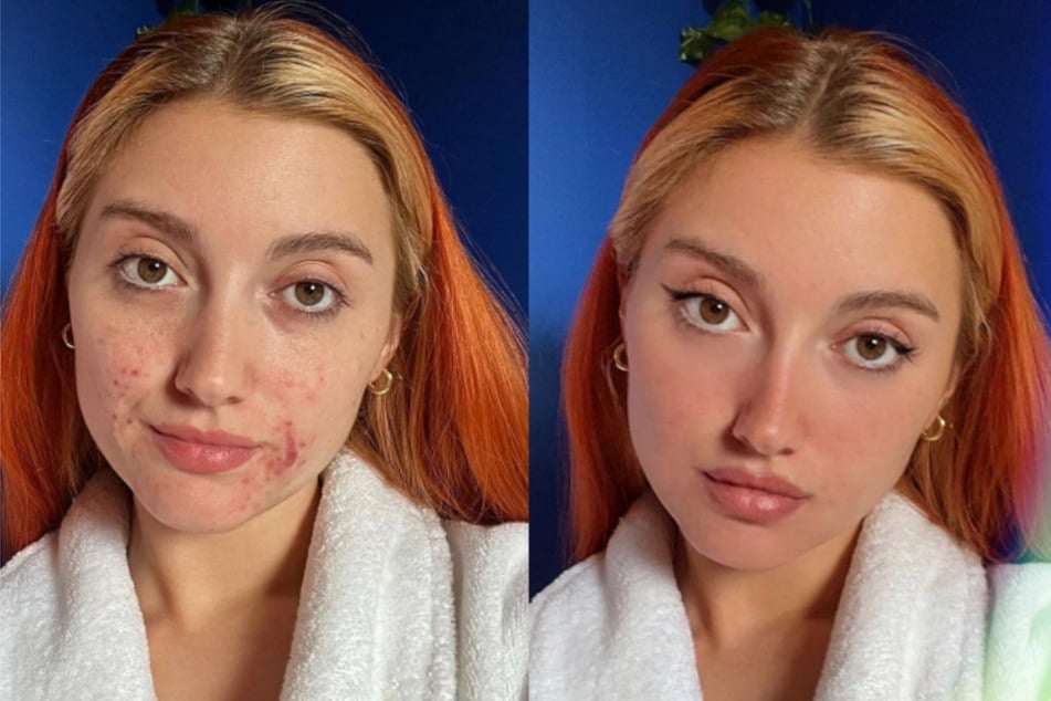 Die Influencerin zeigt in ihrem Post, wie sehr Filter das Gesicht einer Person verändern können.