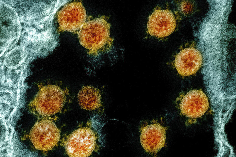 Der Coronavirus SARS-CoV-2 unter dem Mikroskop: Im Herbst könnte das Virus wieder einige Menschen infizieren.