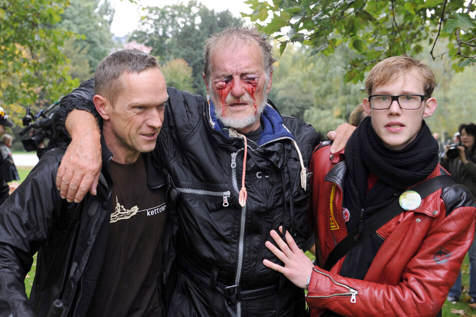 Stuttgart, 30. September 2010: Zwei Männer stützen im Schlossgarten den durch einen Wasserwerfer verletzten Dietrich Wagner. Das Foto ging um die Welt.