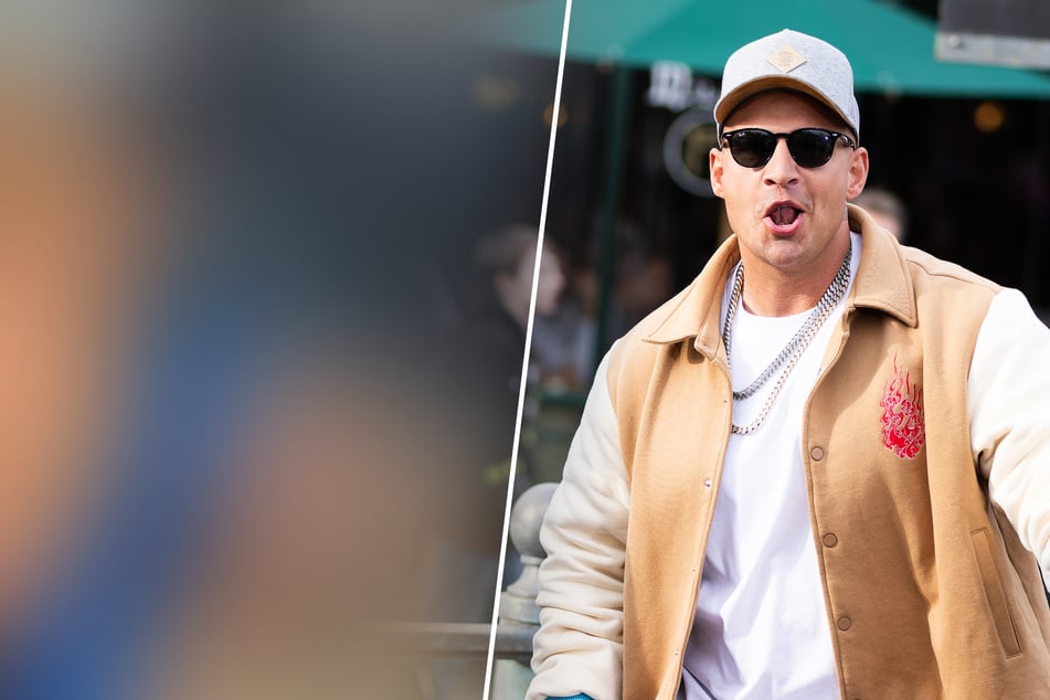 Böses Malheur mit verheerenden Folgen: Pietro Lombardi klagt und zeigt Blessuren